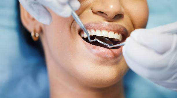 Best Emergency Dental Surgery in Kemmerer, WY