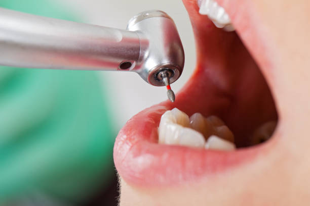 Best Emergency Treatment for Toothache in Kemmerer, WY